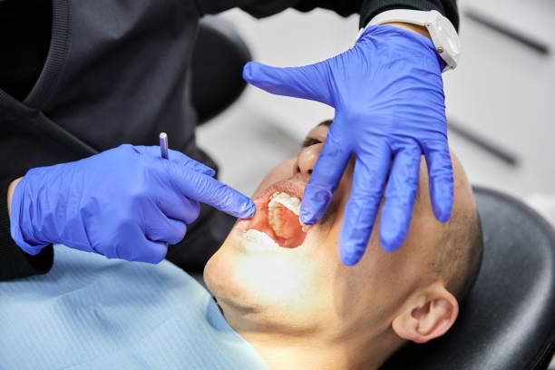 Best Emergency Dental Extractions in Haughton, LA